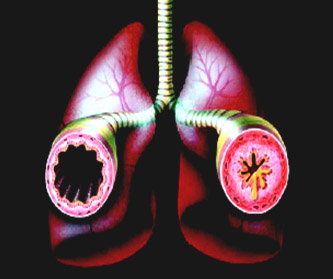 Obesidad y problemas respiratorios